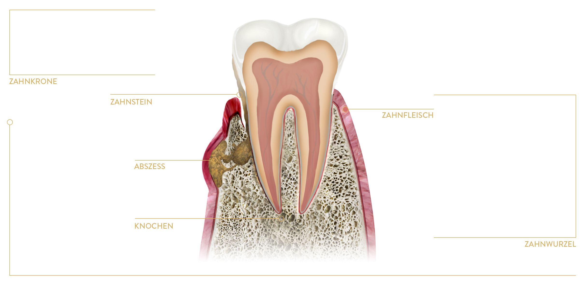 Zähne schmerzen nebenhöhlen WIE SCHMERZEN
