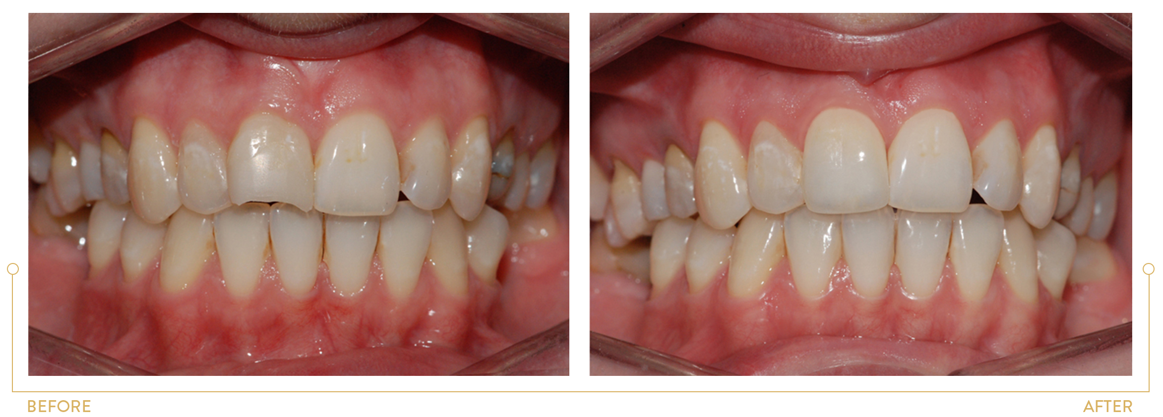Smile makeovers, Transformations in cosmetic dentistry