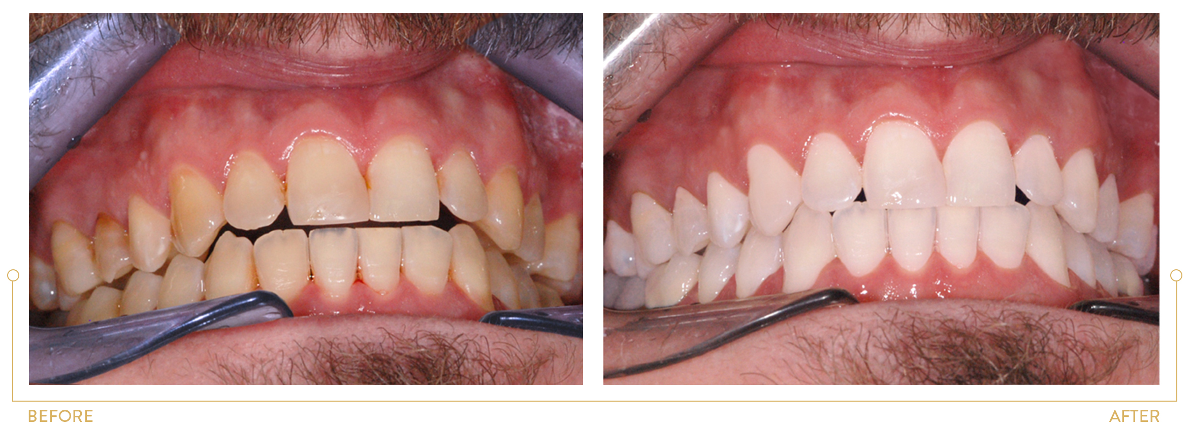 Smile makeovers, Transformations in cosmetic dentistry