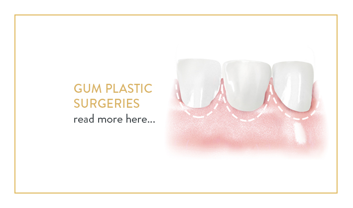 cosmetic dentistry poland, gum plastic surgeries