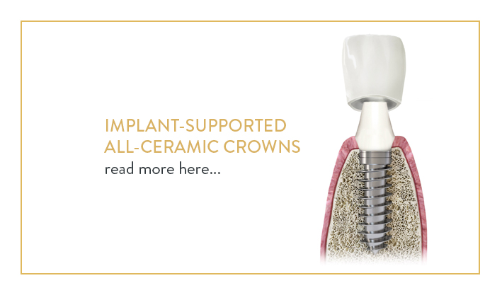 cosmetic dentistry poland, implant-supported all-ceramic crowns